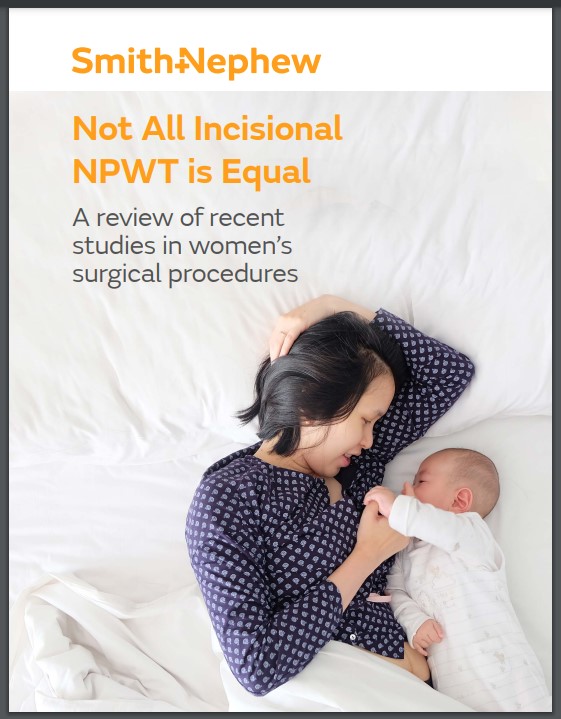 Incisional NPWT: Meet the device with evidence on its side